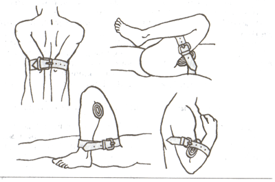 Мал. 9. Варіанти зупинення кровотечі згинанням кінцівок у суглобі.